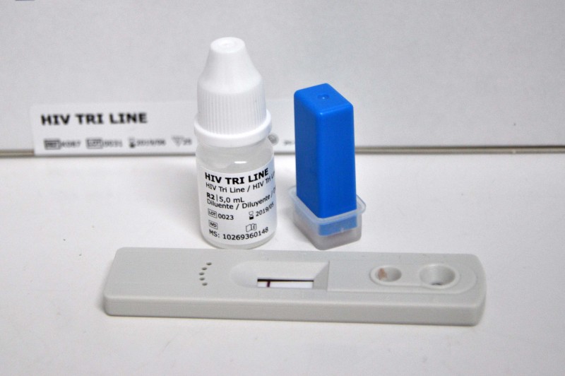 Testes de HIV serão realizados neste sábado